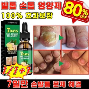 [국내 배송] 손발톱 영양제 문제성 발톱 치료 손톱 강화제 발톱 케어 앰플 네일 리페어 곰팡이 살균, 1개, 30g