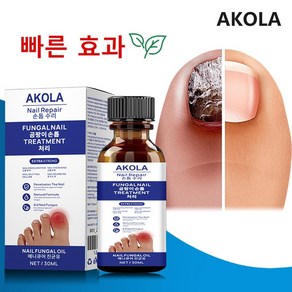 [속달 배송] 무좀 손발톱 건강 회복을 위한 큐티클케어 & 발톱 영양제 발가락 악취 제거 발톱 리페어 에센스 & 무좀 문제 해결, 1개, 10ml