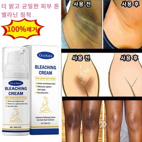 멜라토닌 크림 바디 미백 겨드랑이 엉덩이 색소 침착 연고, 2개, 30ml