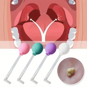편도결석흡입기 편도결석치약 셀프치석제거기 Tonsil 스톤 리무버 진공 키트 흡입 볼 포함 구강 관리 청소 치과 부항 도구, 1개, [01] random color