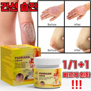 [빨른 배송] 미국 건선 연고 치료제 두드러기 가려움 연고 피부 가려움증 허브 크림, 4개, 20g