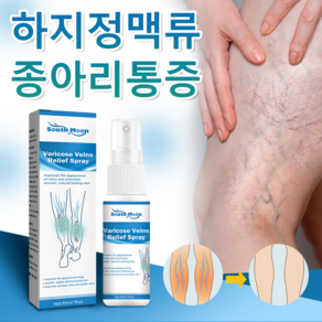 정맥류 스프레이 다리부종 하지정맥 천연 식물 추출 RK001, 1개, 30ml