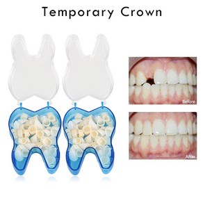 치과 임시 5 개치아 전방 후방 재료치과 도구치과 장비5 개, 단일옵션, 1개