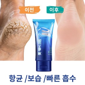 우레아 크림 풋크림 발크림 발각질연화제 고보습 발각질제거 발각질크림 발 관리, 100ml, 1개, 1개입