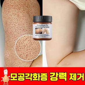 [빠른효과] 모공 각화증 닭살 피부 개선 부드러운 보습 바디 크림