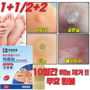 [당일 발출] 티눈제거 발바닥 통증 완화 티눈밴드 보호테이프 손가락 발가락 티눈뿌리 제거 패치, 2개, 10매입