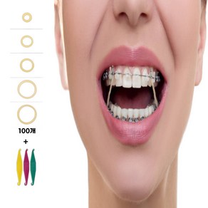 치아 교정고무줄 셀프 착용 교정기 5size [이 이빨 고무 링 밴드 100P], 7.9mm, 1개