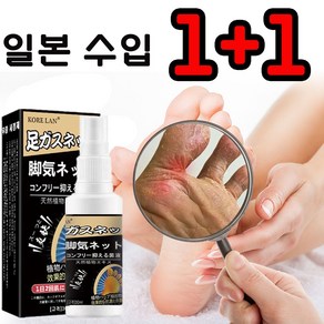 무좀약 발냄새 제거 발바닥 발가락 가려움 완화 발 탈피 습진, 1개, 2개입, 30ml