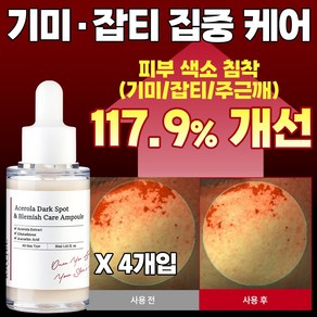 저속노화 3일 잡티케어 글루타치온 기미앰플 아세로라 잡티 기미 앰플 / 임상완료 비타민C의 왕 아세로라 앰플, 30ml, 4개