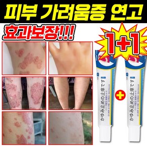 [일본 기술] 피부 가려움증 연고 건선 연고 각종 피부 트러블 곰팡이균 볽은반점 완화 크림, 2개, 20g