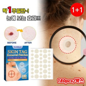 [국내배송] 1+1/2+2 바디 스킨 태그 제거 패치 얼굴 손 발바닥 치료 크림 180pcs/박스, 1+1박스*360매입