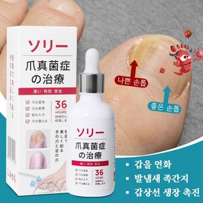 손발톱영양제 발톱 리페어에센스 문제성 손발톱 케어제, 2개, 50ml