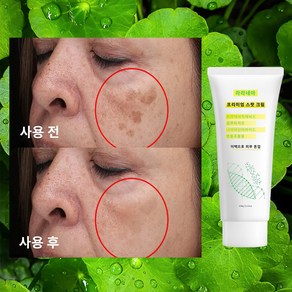 라라네아 트라넥삼산 기미크림 기미잡티크림 크림 대용량 기미잡티크림 바르는 글루타치온, 2개, 100ml