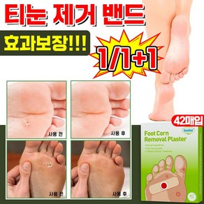 [빠른 배송] 1/1+1 밴드 굳은살 제거 패치 발바닥통증 제거 패치 풋케어 테이프 포장증정, 1개, 42매입