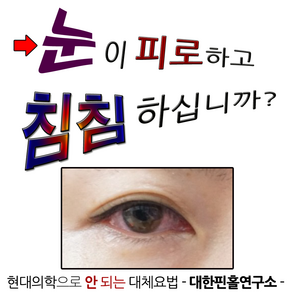 대한핀홀연구소 난시 근시 노안 약시 시력교정 특허품 분야별 명품 핀홀안경, 1개, 아이센스탑_남녀공용