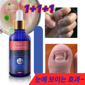 부베비르 회색손톱진균 앰플, 50ml, 3개, 1개입