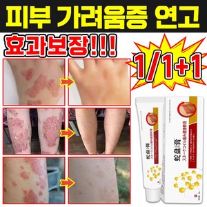 [일본 기술] 1/1+1 피부 가려움증 연고 한포진 습진 연고 건선 연고 치료제 피부염 모낭염 연고 지루성 피부염 각종 피부 트러블 곰팡이균 볽은반점 완화 크림, 1개, 20g