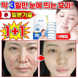 [100% 주름제거] 1+1/2+2 링클 리페어 팔자 주름패치 주름개선 패치 팔자주름없애기 미간 이마 입가 잔주름 제거 패치 리프팅 팩 포장증정, 2개, 18개입
