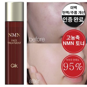 GIK NMN 페이스 트리트먼트 미백 고농축 탄력 수분 토너, 1개, 180ml