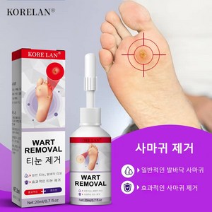 [국내배송/당일배송] 1+1 발가락 발바닥 제거 발가락 연고, 1개, 20ml