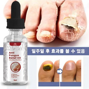 발톱 무좀 케어 손톱진균 발톱무좀 큐티클 트리트먼트 에센스, 10ml, 6개, 1개입