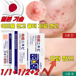 [국내배송] 일본 여드름 연고 흉터 치료 연고 청소년 피부 화농성 여드름 제거 리페어 연고 모공 진정 피지케어 크림, 30ml, 5개