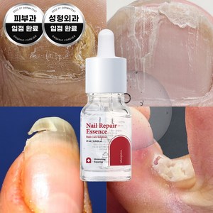 메디올가 네일 리페어 에센스, 15ml, 2개