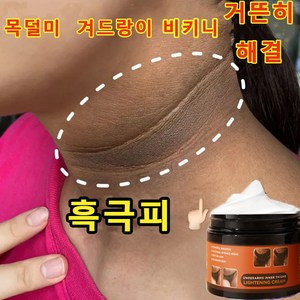 MEJIOSS [대용량] 멜라토닝크림 색소침착 연고 색소침착연고 겨드랑이 색소침착 색소침착연고 멜라닌 억제, 2개, 140g