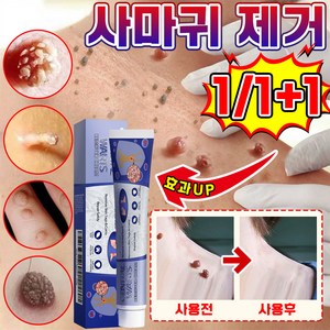 [국내배송] 1+1/2+2 미국 피부 치료 제거 연고 신속하고 효과적인 제거 스킨 제거 크림 최저가격 포장증정, 1개, 20g