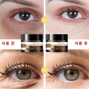 눈밑지방재배치 비 지방 육아종 제거 크림 주름과 다크 서클을위한 아이 크림 콜라겐 눈밑지방, 4개, 50ml