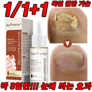 최신 기술 1/1+1 딱 3일!!! 효과보장 발톱 완화 영양제 천연 성분 손톱 리페어 에센스, 2개, 20ml