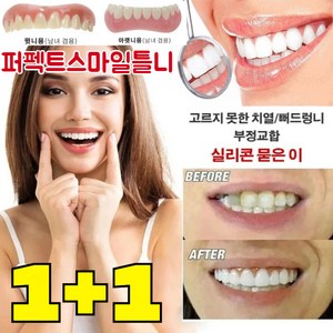 [국내배송] 1+1 퍼펙트스마일틀니 임시 틀니 재사용 가능/눈에 띄지 않음/간단히 탈부착, 상하 세트*1+1