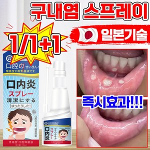 [빠른배송] 구내염 잇몸 염증 구강 스프레이 치주염 혀 구내염 약 가글 미스트 구취 제거 항균 혓바늘 구강 궤양 통증 치료 마우스 스프레이, 1개, 30g