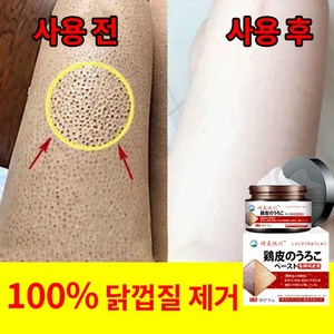 모공 각화증 각화모공각화증 닭피부 수분보습 바디크림, 1개, 30ml