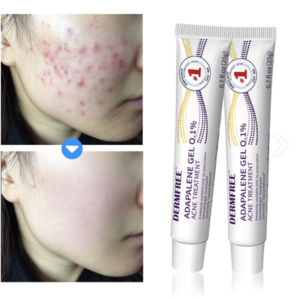 DERMFREE 트러블케어 리페어 크림 스팟 케어 문제피부 자국 모공 진정 피지케어 크림, 2개, 20g