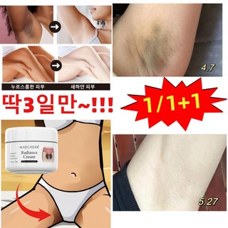 Y존 멜라닌 제거 겨드랑이 색소침착 미백 크림 멜라닌 억제팔꿈치 사타구니 미백, 50g, 1개