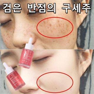 나이아신아마이드 10% 트라넥삼산 에센스 세라마이드 기미제거 미백 한 병의 효험, 3개, 30ml