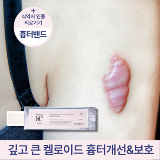 더마에스씨 수술흉터밴드