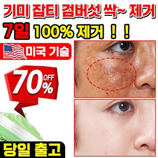 [국내배송] 1 / 1+1 기미 크림 기미 잡티 주근깨 검버섯 제거 크림 색소침착 케어 주름 미백 톤업 기능성 들깨 기미 크림 포장증정, 3개, 30g