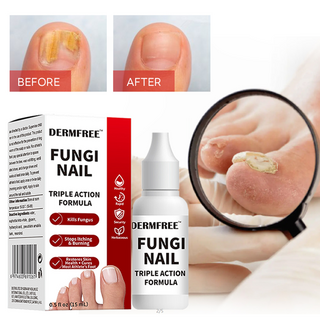 손톱영양제 강화제 문제성손발톱 리페어 세럼 손톱재생 내성발톱 1개 15ml 상품 이미지