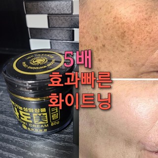 5배빠른 강화 검버섯크림/반점, 2-5)검버섯 나도미크림1 주름제거 아이크림1, 50ml, 1개