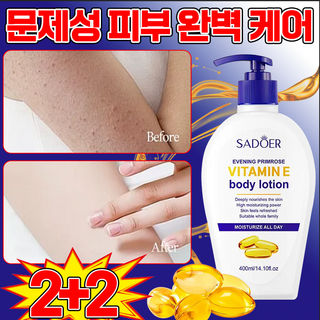 [즉각보습] 고보습 바디로션 모공각화증 바디로션 문제성피부 여성 남자 바디크림, 4개, 400ml