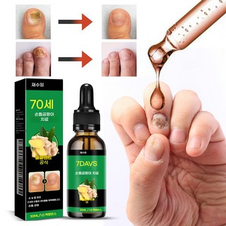 손발톱 영양제 손상된 손톱 복원 & 곰팡이 케어 앰플, 4개, 30ml