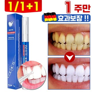 독일 1/1+1 화이트닝 셀프 치아 미백제 미백 치약 프리미엄 치아 미백 겔 치석 구취케어 입냄새 누렁니 제거 치약, 1개, 29g