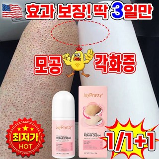 모공각화증크림