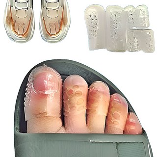 이몰즈 실리콘 발가락골무 10Pset (엄지 새끼 검지 중지 넷째), 1개