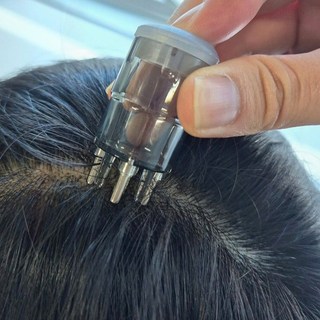 두피 마사지기 미니 앰플 도포기 헤어 케어 모발 관리 휴대용, 1개, 상세페이지 참조