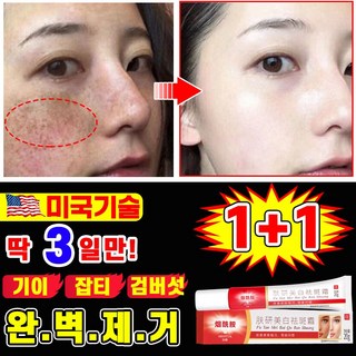 기미 잡티 제거 크림