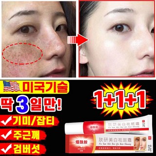 [당일발송] 1/1+1/2+2 기미 잡티 검버섯 주근깨 제거 크림 멜라토닝 멜라논 크림 들깨기미크림 화이트닝 스팟 크림 색소침착 얼국 미백 포장증정, 3개, 20g