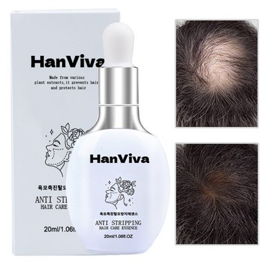 HanViva 헤어 발모제 두피 양양제 헤어에센스 머리 케어 모낭 보습 성장 촉진 에센스, 1개, 20ml_풍성한 머리로 변신